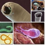 Worms and Intestinal Parasites: Causes, Symptoms and Treatment - NatureWord