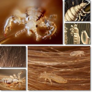 Where Do Head Lice Come From? (Myths and truths) - NatureWord